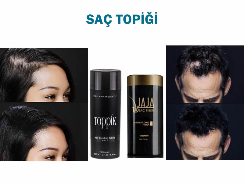 Saç Topiği